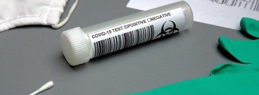 testy na przeciwciała covid19